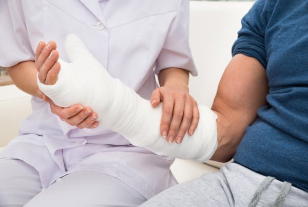 Fracture
