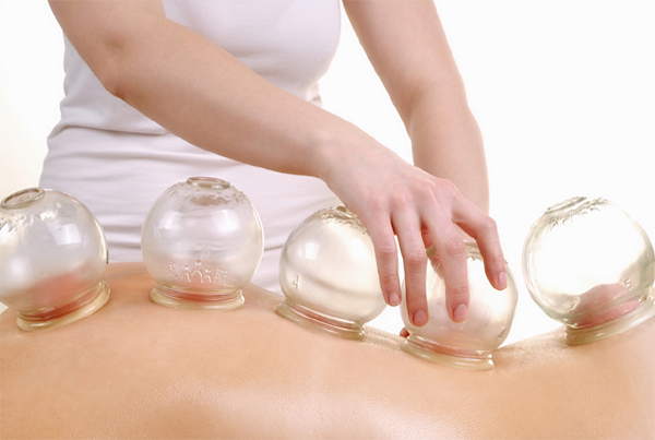 Cupping Therapy